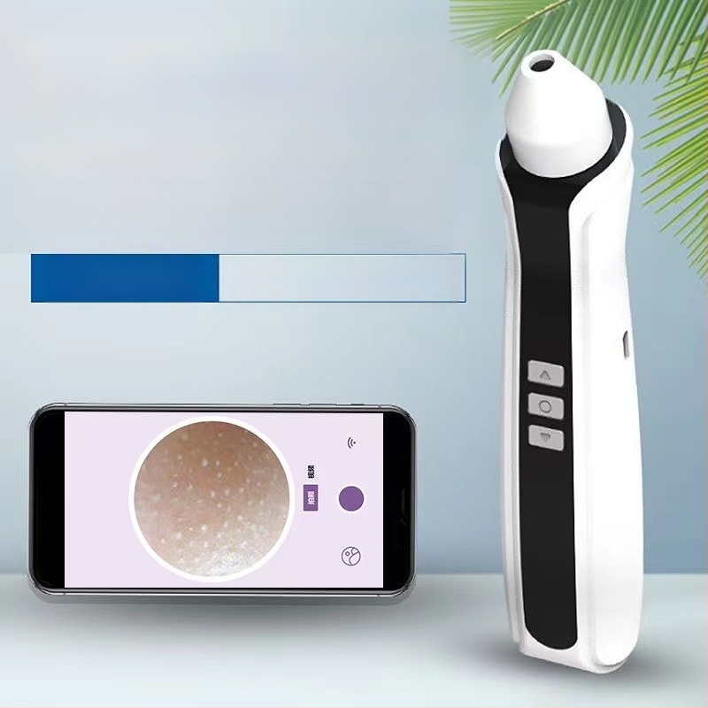 Визуално премахване на черни точки — ултразвуков ръчен уред, модел ZM613, ABS корпус, 3 степени на настройка