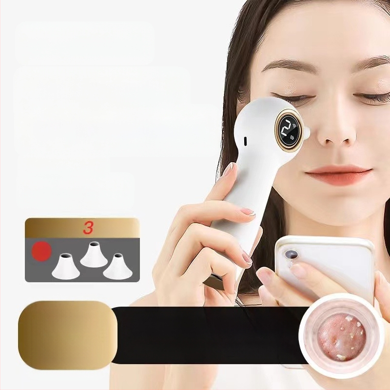 Визуално премахване на черни точки — ултразвуков ръчен уред, модел ZM613, ABS корпус, 3 степени на настройка