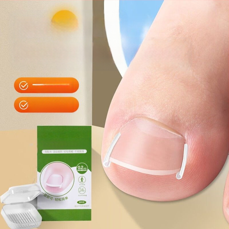 Μίνι πλαστικό υπόθεμα διόρθωσης για το νύχι του μεγάλου δακτύλου, φορητό και σκίζεται