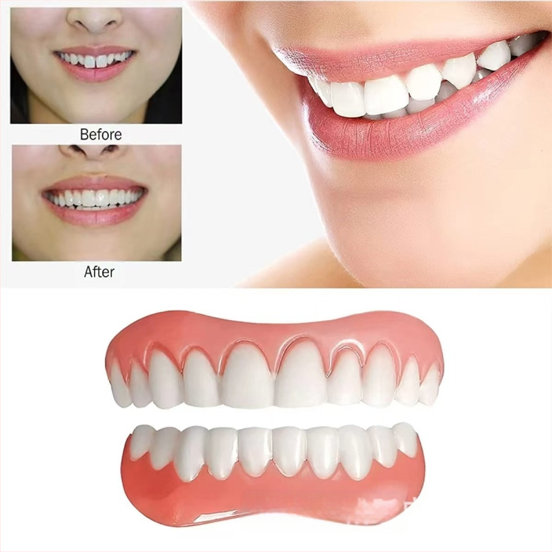 Protēžu komplekts – augšējā un apakšējā pilns komplekts, tūlītējs smaids, balināšana, reālistiski zobi