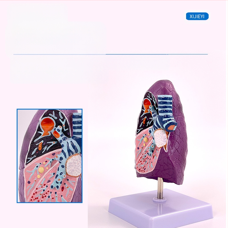 Blue Butterfly пластмасов модел на вътрешни органи: човешка трахея и белите дробове - анатомия и патология с разрез на пушач.