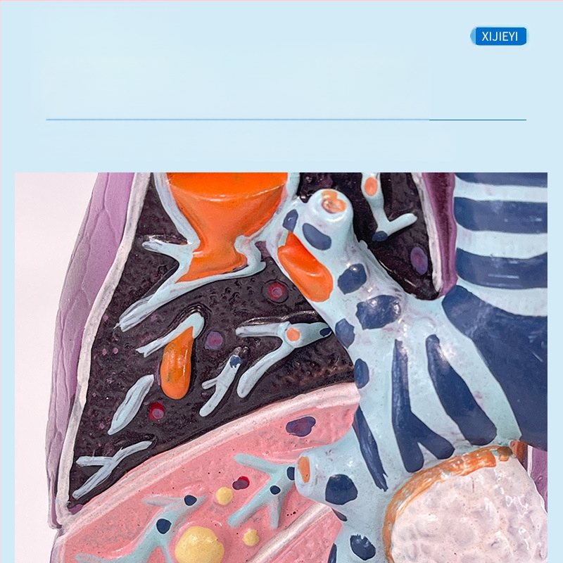 Blue Butterfly пластмасов модел на вътрешни органи: човешка трахея и белите дробове - анатомия и патология с разрез на пушач.