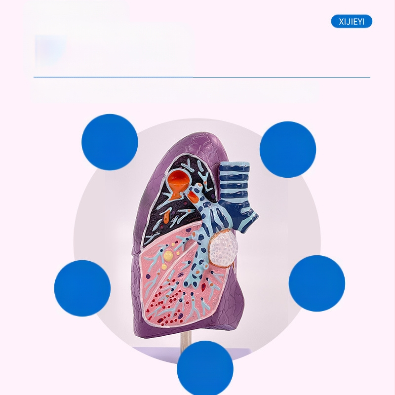 Blue Butterfly пластмасов модел на вътрешни органи: човешка трахея и белите дробове - анатомия и патология с разрез на пушач.