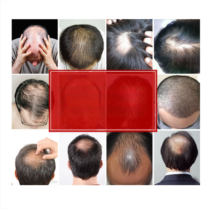 Мъжка перука BF23, естествена човешка коса, къса дължина, механизъм на обработка, неподходяща за горещо боядисване