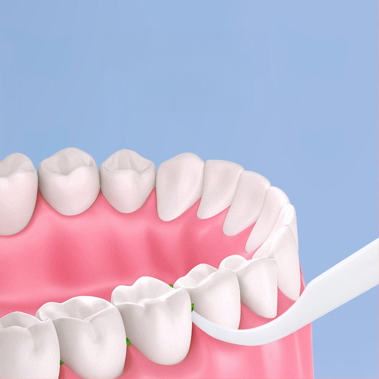 Ράβδοι οδοντικού νήματος υπερλεπτές, μίας χρήσης, από πλαστικό, ατομικά συσκευασμένες, 30–50 τεμάχια ανά σετ