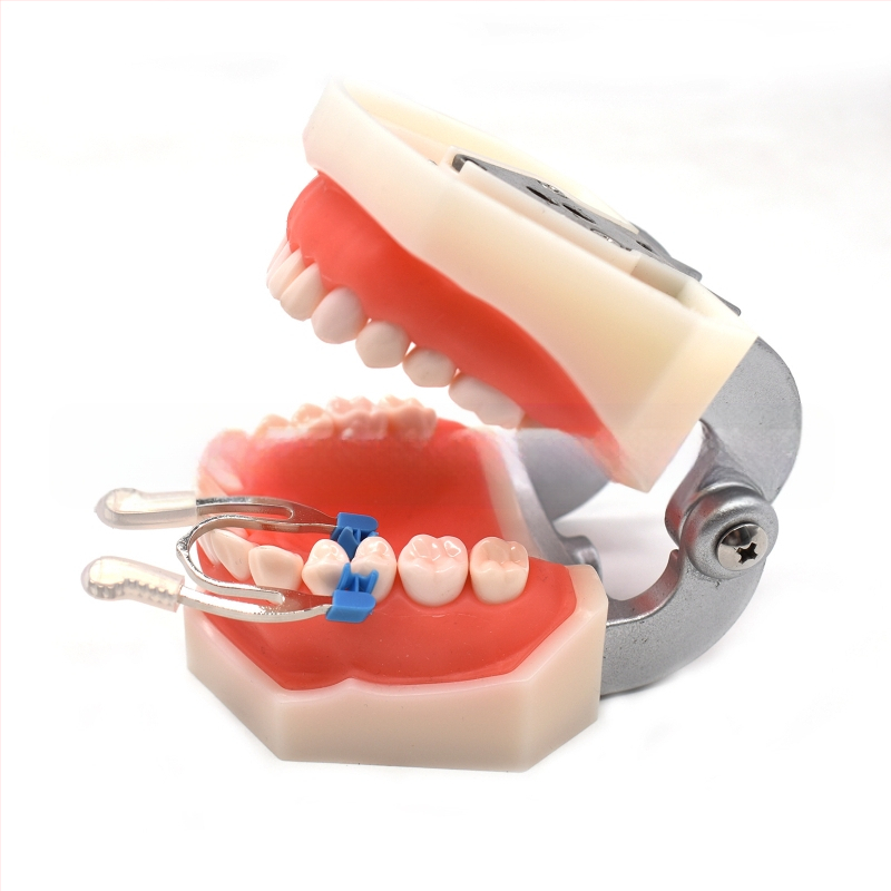 Zobu veidošanas klips, LNGL, A/B tipa stiprinājumi, 23 g kastē, 200 gabalos iepakojumā