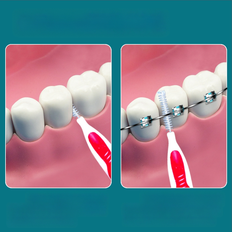 Ορθοδοντική interdental βούρτσα, σετ 10 τεμάχια, ultra-fine απαλές τρίχες, σύρμα από ανοξείδωτο χάλυβα