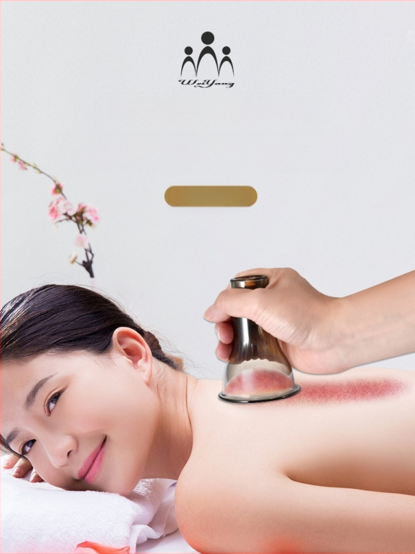 Weiyang uređaj za vakuumske ventuze, podrijetlo Shandong, za zdravstveni masažni tretman, materijal: drugi.