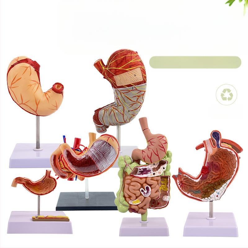 Модел на човешки стомах за анатомия — коронален разрез, патологичен модел със перфорация, обучение по гастроентерология