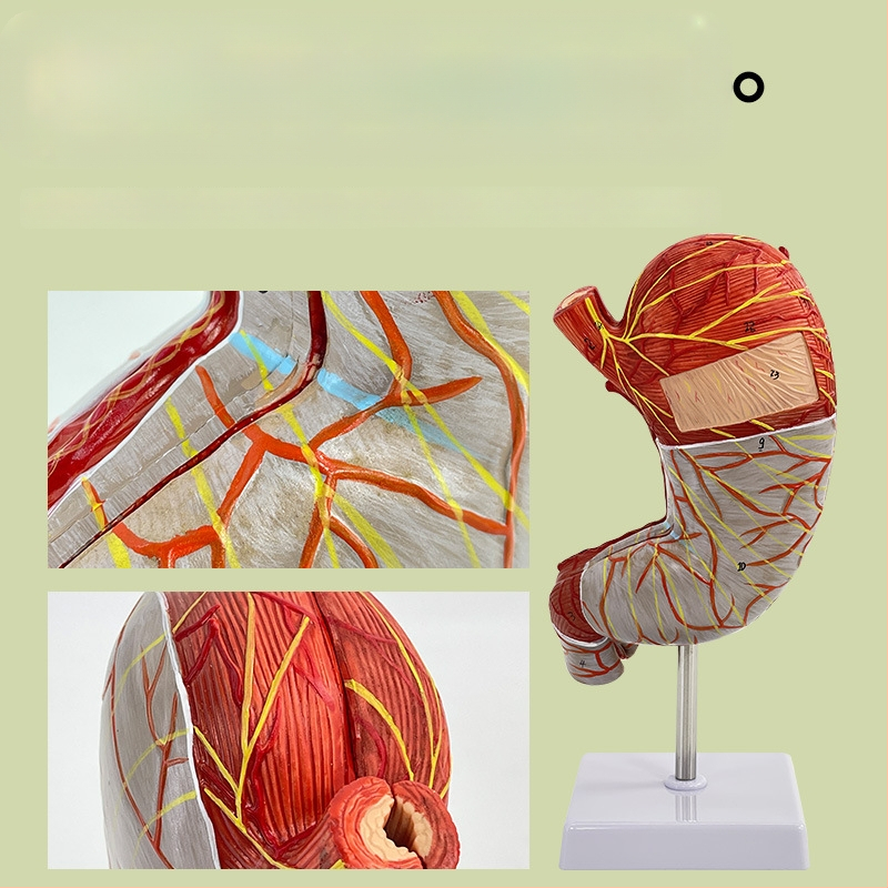 Модел на човешки стомах за анатомия — коронален разрез, патологичен модел със перфорация, обучение по гастроентерология