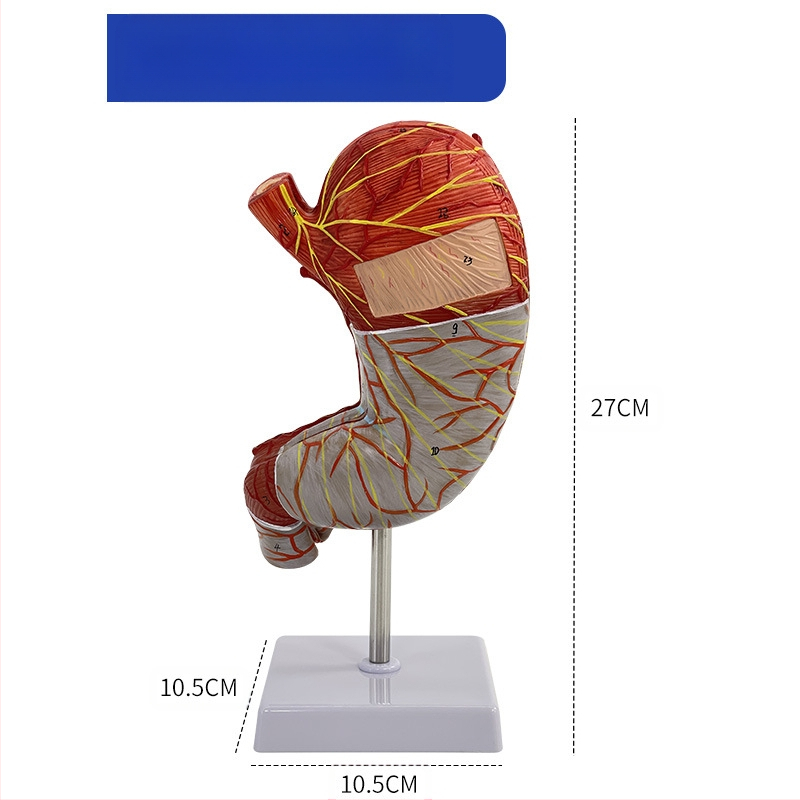 Модел на човешки стомах за анатомия — коронален разрез, патологичен модел със перфорация, обучение по гастроентерология