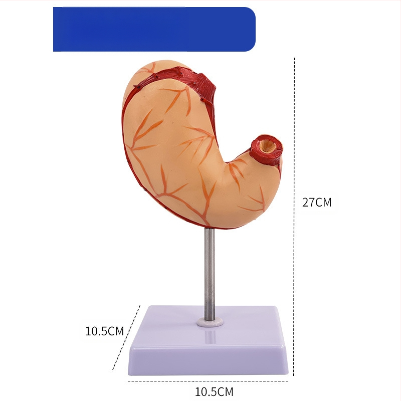 Модел на човешки стомах за анатомия — коронален разрез, патологичен модел със перфорация, обучение по гастроентерология
