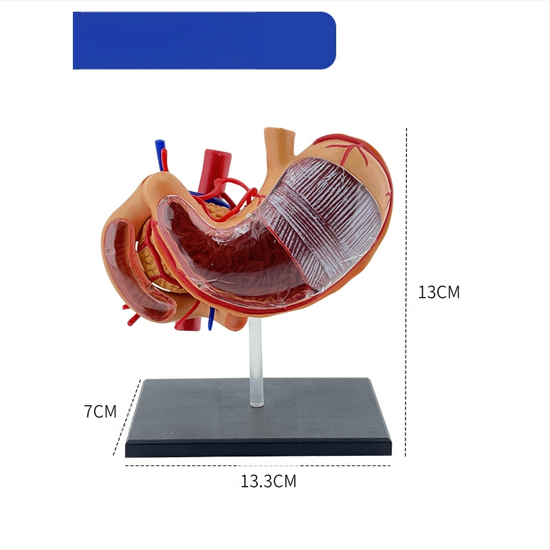 Модел на човешки стомах за анатомия — коронален разрез, патологичен модел със перфорация, обучение по гастроентерология
