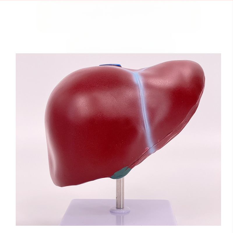 Ļoti reālistisks aknu anatomijas modelis ar hepatobiliāro–pankreato-splēnas-duodēnu sistēmu un reljefa bojājumiem
