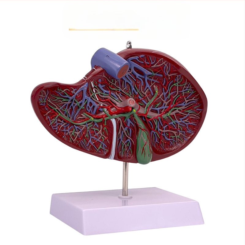 Ļoti reālistisks aknu anatomijas modelis ar hepatobiliāro–pankreato-splēnas-duodēnu sistēmu un reljefa bojājumiem