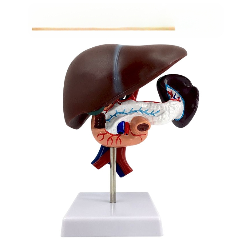 Ļoti reālistisks aknu anatomijas modelis ar hepatobiliāro–pankreato-splēnas-duodēnu sistēmu un reljefa bojājumiem