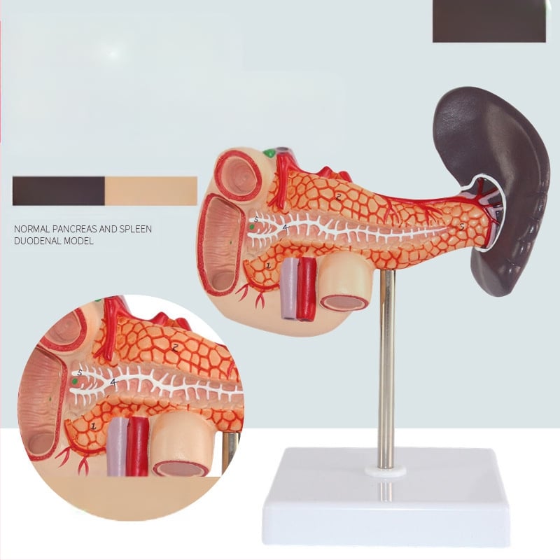 Ļoti reālistisks aknu anatomijas modelis ar hepatobiliāro–pankreato-splēnas-duodēnu sistēmu un reljefa bojājumiem