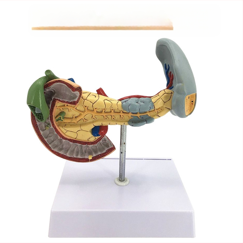 Ļoti reālistisks aknu anatomijas modelis ar hepatobiliāro–pankreato-splēnas-duodēnu sistēmu un reljefa bojājumiem