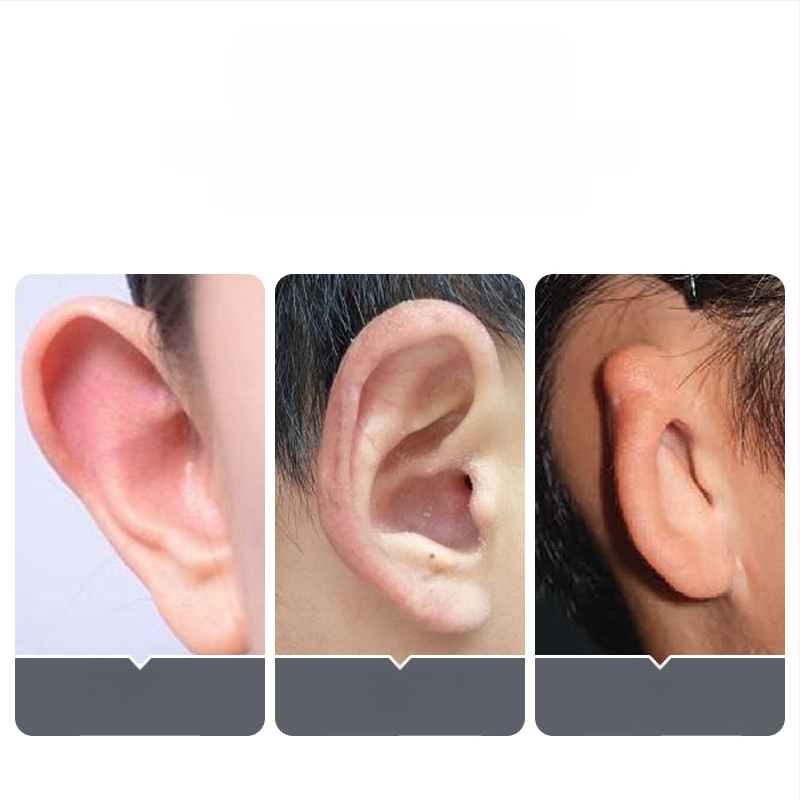 Nähtamatu silikoonist kõrvakorrektsiooni plaastrid – mõeldud imikutele, lastele ja teismelistele; netokaal 50 g.