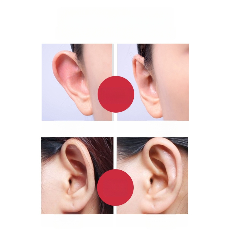 Nähtamatu silikoonist kõrvakorrektsiooni plaastrid – mõeldud imikutele, lastele ja teismelistele; netokaal 50 g.