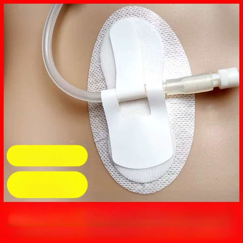 Αποστειρωμένος Φιξатор Καθετήρα με Οπή Αποχέτευσης, από μη υφαντό και ελαστικό ύφασμα, με ιατρικό κόλλητικό, ατομικά συσκευασμένο