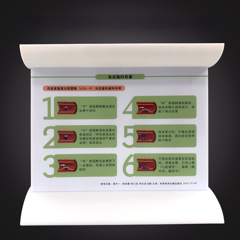 Dinaminis kraujagyslių modelis iš plastiko su didelio tankio užsikimšimu ir plokštelių trombu – mokymo modelis