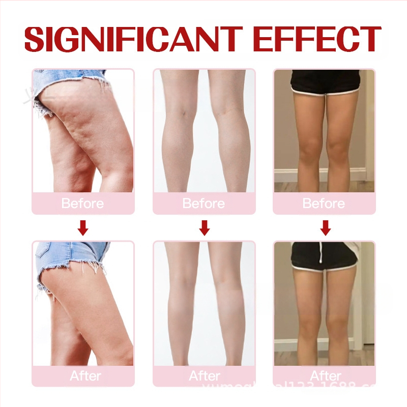 Yumebeauty ταινία ανύψωσης μηρών για μορφοποίηση σώματος, ιατρικός υποαλλεργικός αυτοκόλλητος επίδεσμος, 10 τεμάχια ανά σετ