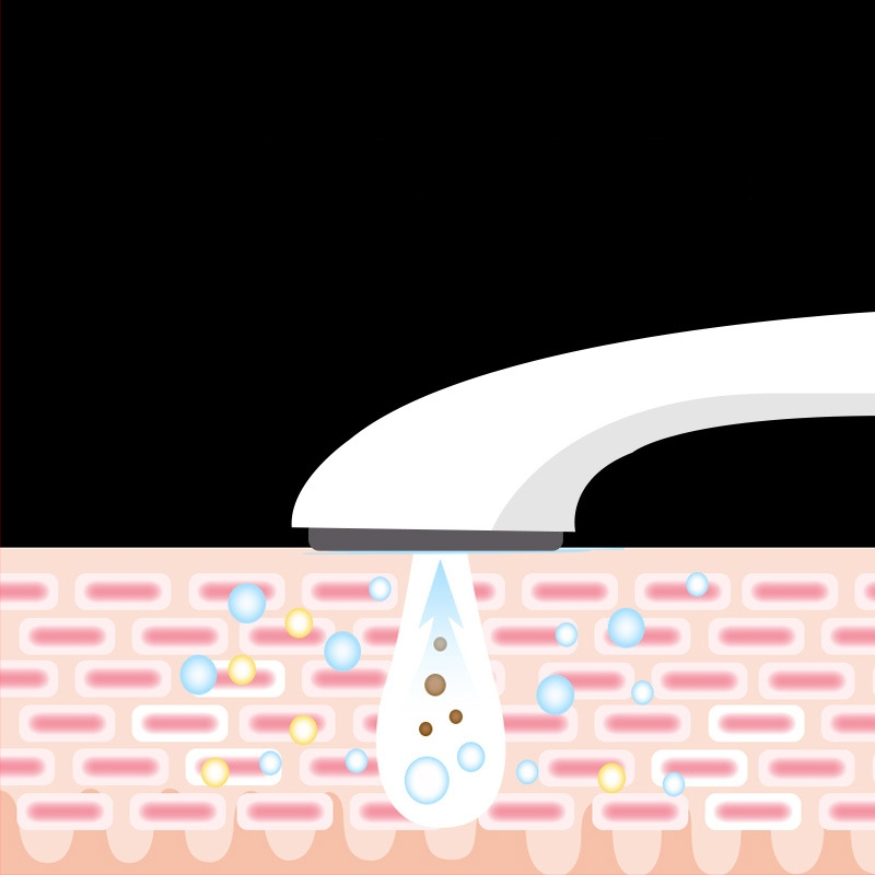 Ionový kozmetický prístroj pre domáce použitie - čistenie, obnovenie pokožky, prenosný, IPX3 vodotesnosť