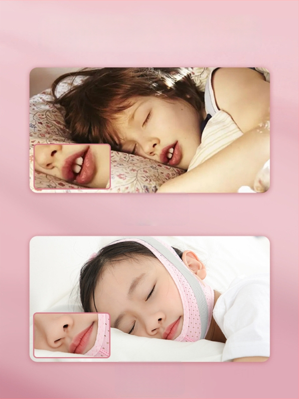 Vaikams skirtas burnos kvėpavimo korekcijos diržas — užkerta kelią burnos atidarymui miego metu; Prekės ženklas Li Yue, Modelis: Mouth Breathing Correction Belt