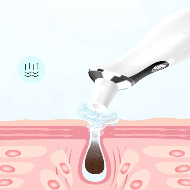 Vakuuminis veido valymo įrenginys juodoms inkštirams pašalinti, modelis DYM028, Define Beauty, aiškiai pašalina inkštirus ir spuogus, 3 galingumo režimai