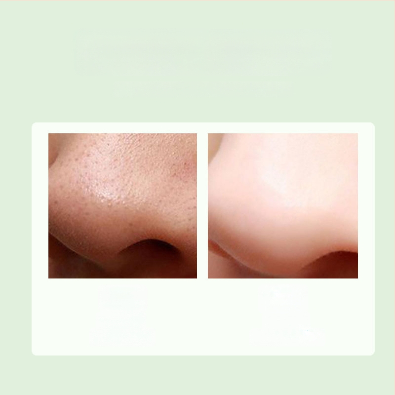 Vakuuminis veido valymo įrenginys juodoms inkštirams pašalinti, modelis DYM028, Define Beauty, aiškiai pašalina inkštirus ir spuogus, 3 galingumo režimai