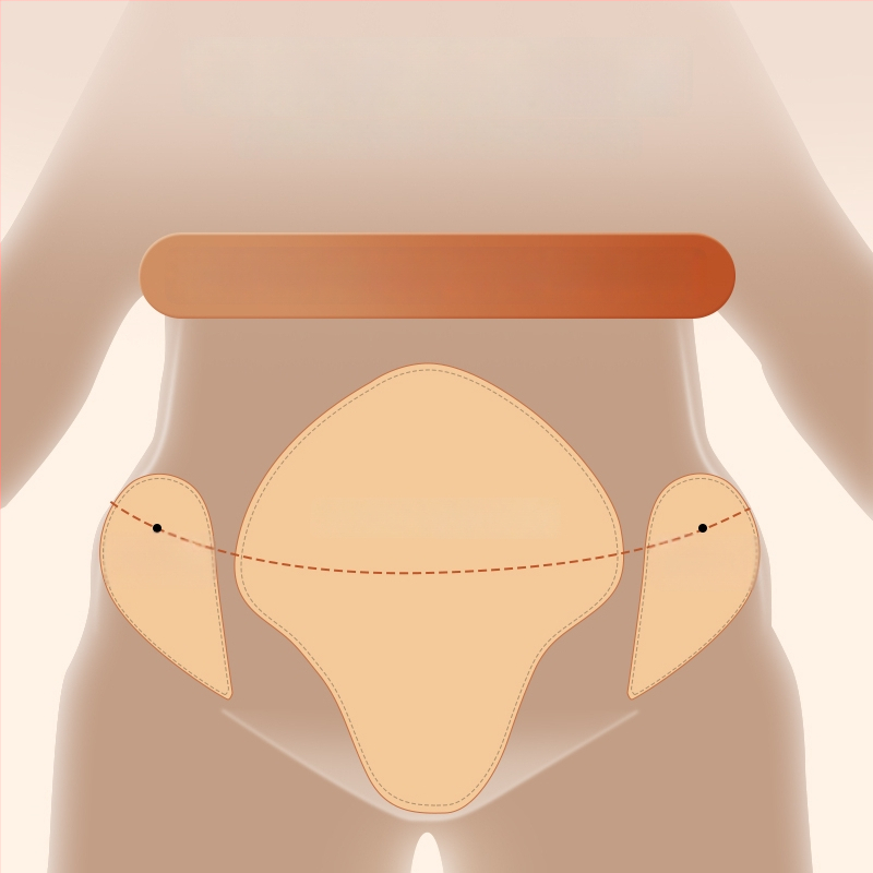 Meridiaaniharja kõhtu masseerimiseks – Kõhu masseerija, jalgade kõõluste massaaži tööriist, impulsi puhastus seade (Bränd: Zhebao; Spetsifikatsioonid: Regular; Kaal: 200 g; Kast: 100 tk)