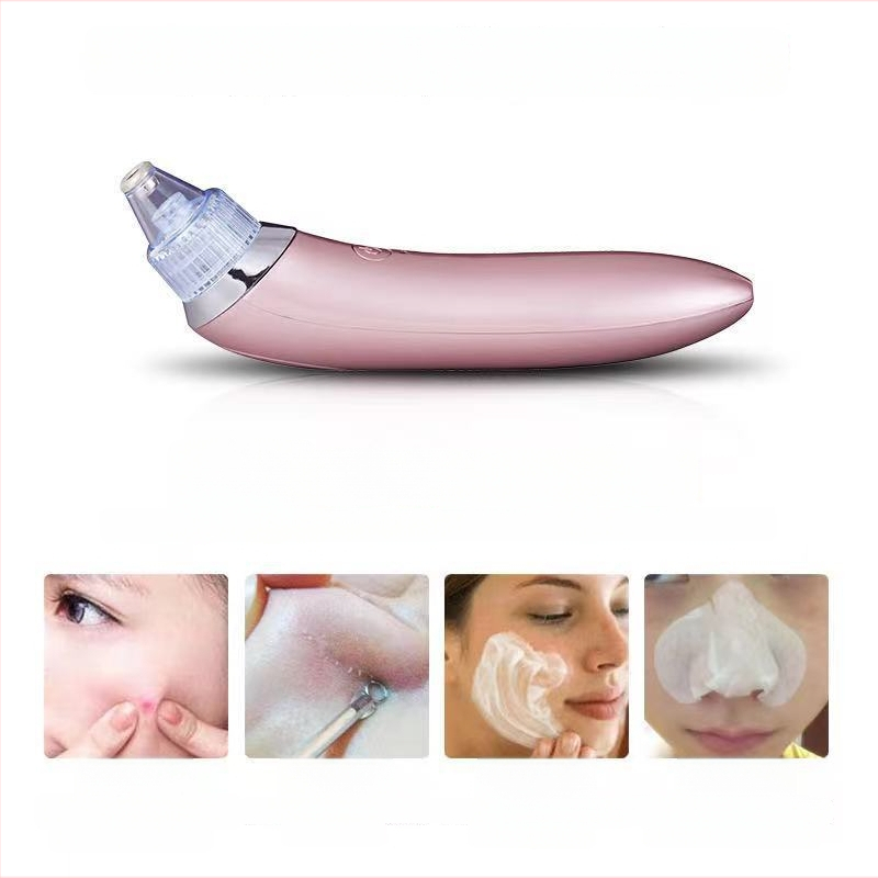 Porų valiklis – Juodųjų taškų siurbimo įrenginys, 5 režimų reguliavimas, ABS korpusas, išleistas 2020 m.