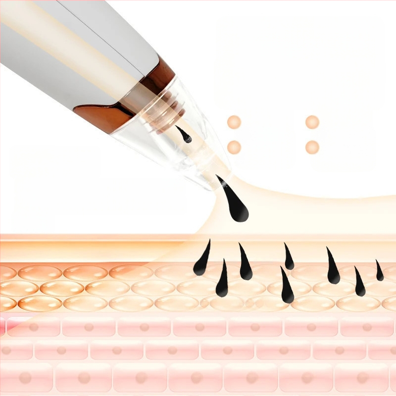 Juodųjų dėmių siurbimo įrenginys — elektrinis, namų naudojimui, stiprus siurbimas, modelis 5678, 3 greičiai, odai saugu