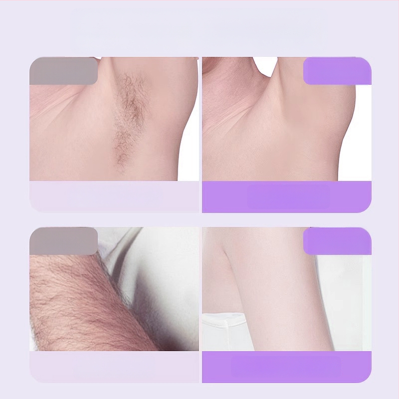 TMQ-623 Elektrinis skutimosi peiliukas ir plaukų šalinimo priemonė su deimantinę ašmenį, USB įkrovimas, drėgnas ir sausas naudojimas, visam kūnui