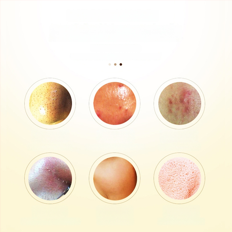 YKANG RF näoseade ilu - kaasaskantav näopuhastuslaite negatiivsete ioonidega, sisseehitatud aku <300 mAh, IPX0