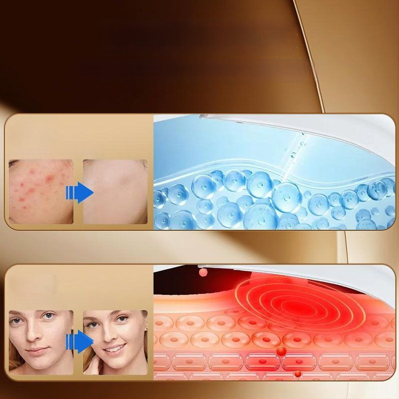 Näo vormimise seade EMS mikrovooluga, ultraheli ja värvilise valgusega, kaasaskantav, sisseehitatud 300–500 mAh aku