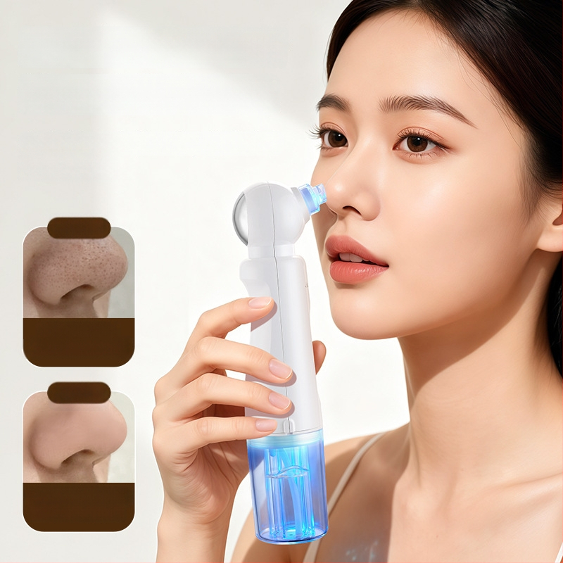 Chigo X20 vakuuminis porų valymo įrenginys su karštojo kompreso funkcija poroms atidaryti, 4 lygis