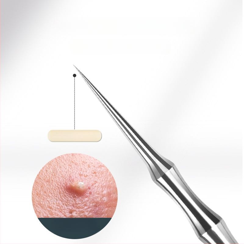 Spuogų adatos ir inkštirų šalinimo rinkinys, itin aštri No. 5 galvutė, nerūdijantis plienas