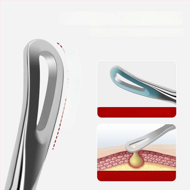 Spuogų adatos ir inkštirų šalinimo rinkinys, itin aštri No. 5 galvutė, nerūdijantis plienas