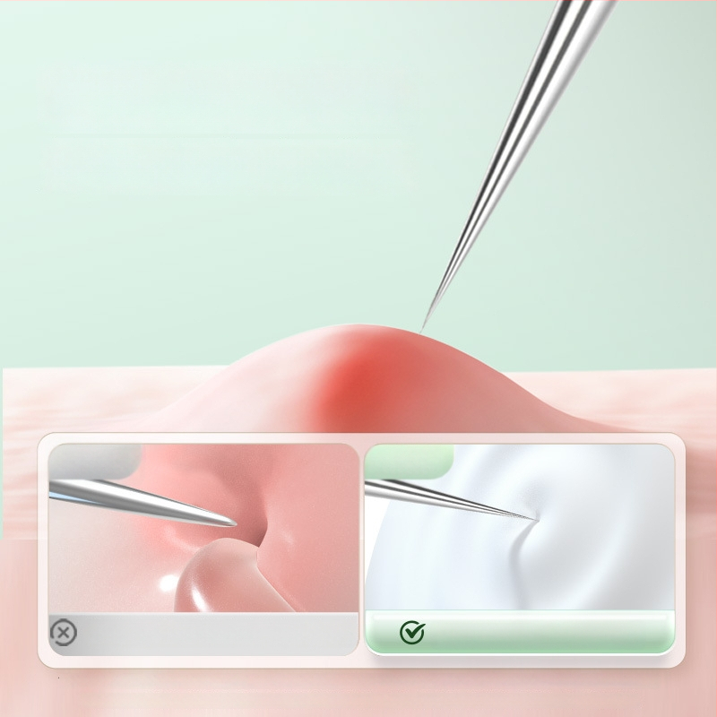 Profesionalus spuogų adatų rinkinys su ultra aštriais plonais adata ir juodųjų taškų šalinimo antgaliais, nerūdijantis plienas – Nilia