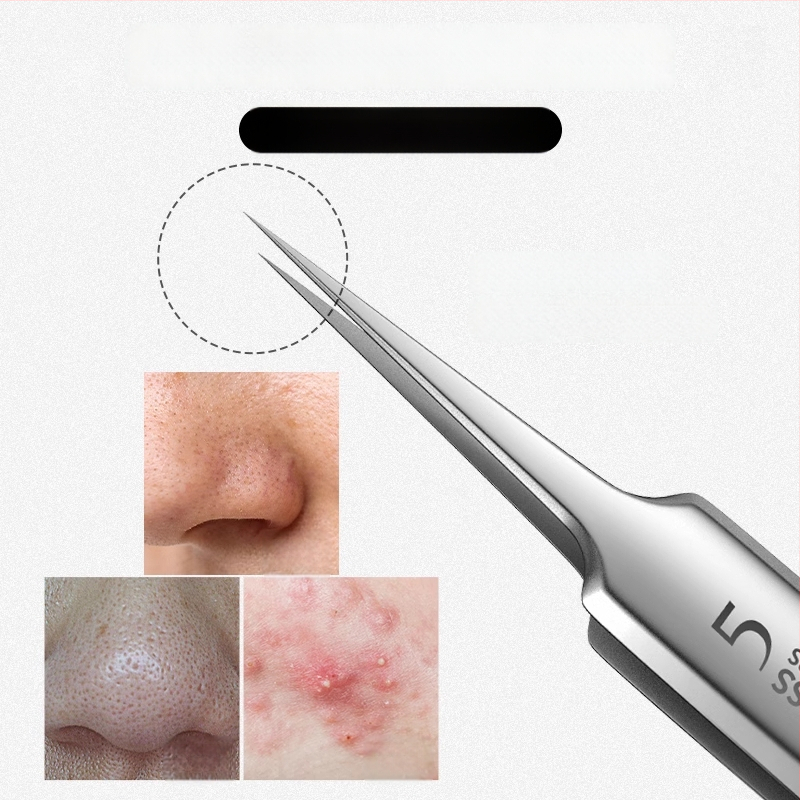 Akne ištraukimo įrankių rinkinys – nerūdijantis plienas, ultra aštrūs galiukai, juodųjų spuogų šalinimas, Daisy prekės ženklas, galiojimo laikas 2 metai