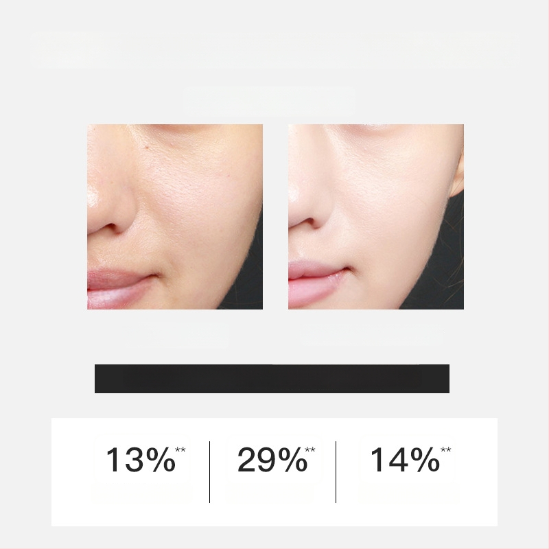 Peel-off kaukė, skirta riebalų kontrolei, porų susiaurinimui, inkštirų šalinimui ir giluminiam valymui – visiems odos tipams
