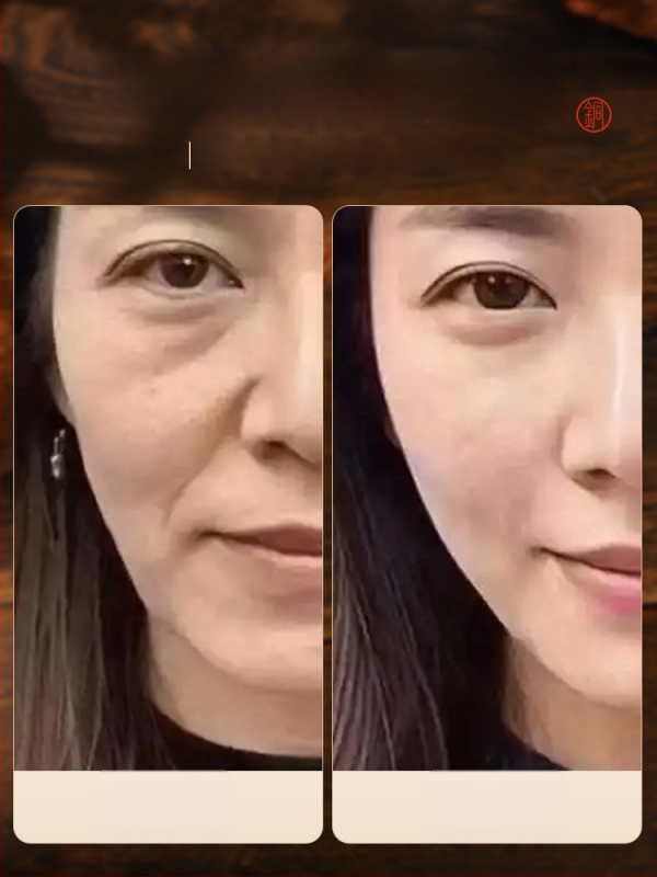 Sejas masāžas plāksne — Simple element; materiāls: Cits; svars: 100; izdrukāts zīmogs: Jā; apstrāde un pielāgošana: Jā