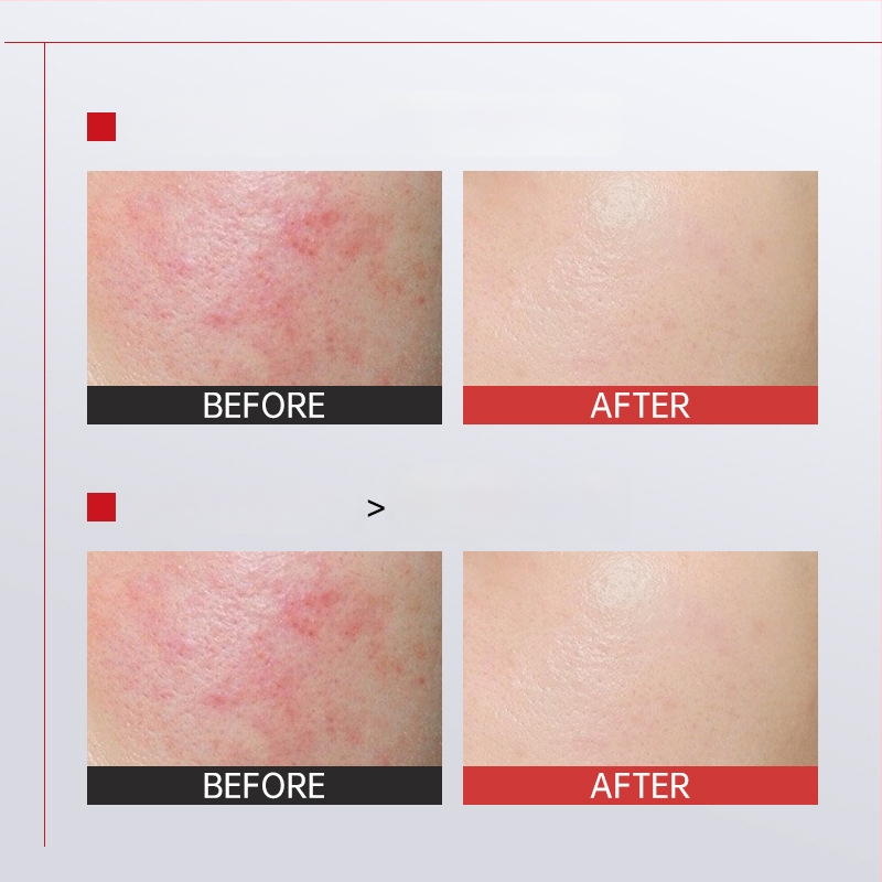 Hanjilian rahustav öömask – kreemi-gel mask niisutamiseks, rahustamiseks ja pehmuseks; sobib segatüüpi nahale; säilivusaeg 3 aastat