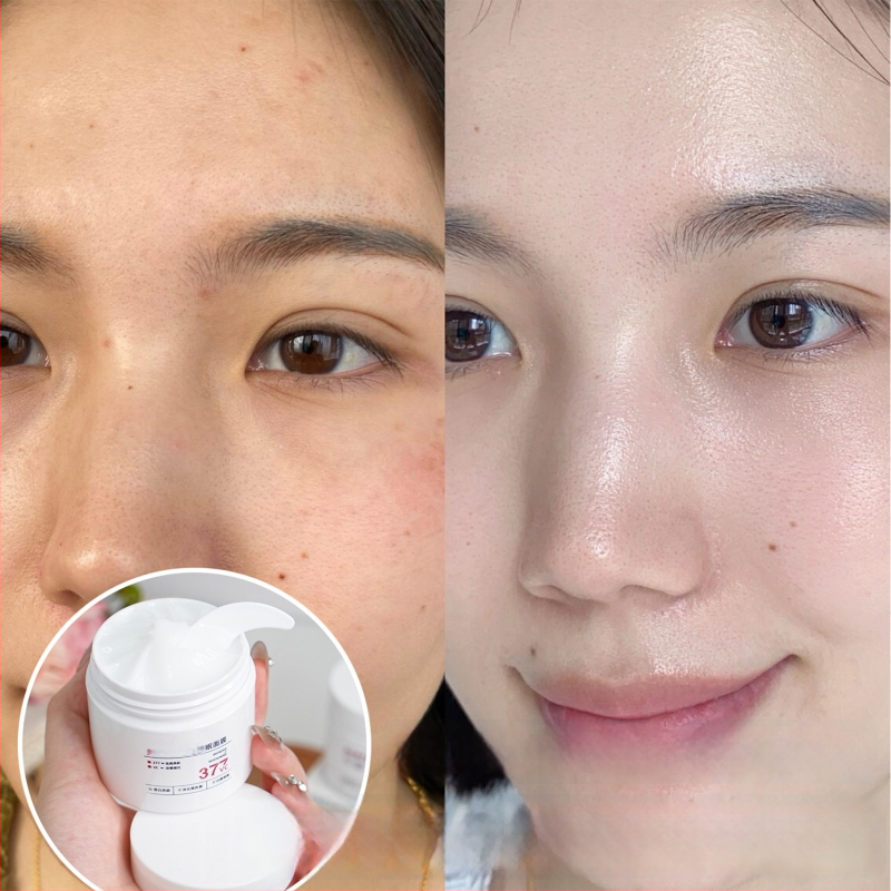 Balinanti ir atnaujinanti naktinė kaukė prieš raukšles (kremas-gelis) — riebalų kontrolė, juodųjų dėmių pašalinimas, drėkinimas, stanginimas