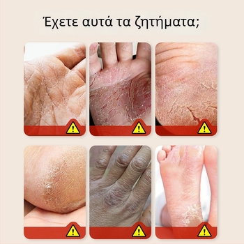 Επίθεμα με λάδι αλόγου για ξηρές παλάμες και πόδια, 50 επιθέματα ανά κουτί, υφή αλοιφής, βότανο άρωμα