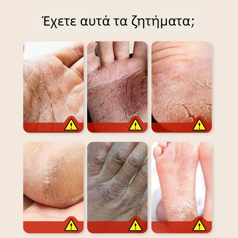 Επίθεμα με λάδι αλόγου για ξηρές παλάμες και πόδια, 50 επιθέματα ανά κουτί, υφή αλοιφής, βότανο άρωμα