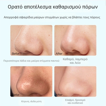 Μάσκα απομάκρυνσης μαύρων στιγμάτων με εκχύλισμα τσαγιού – σετ τριών τεμαχίων, φροντίδα ζώνης Τ, σύσφιξη πόρων, έλεγχος λιπαρότητας, ενυδάτωση