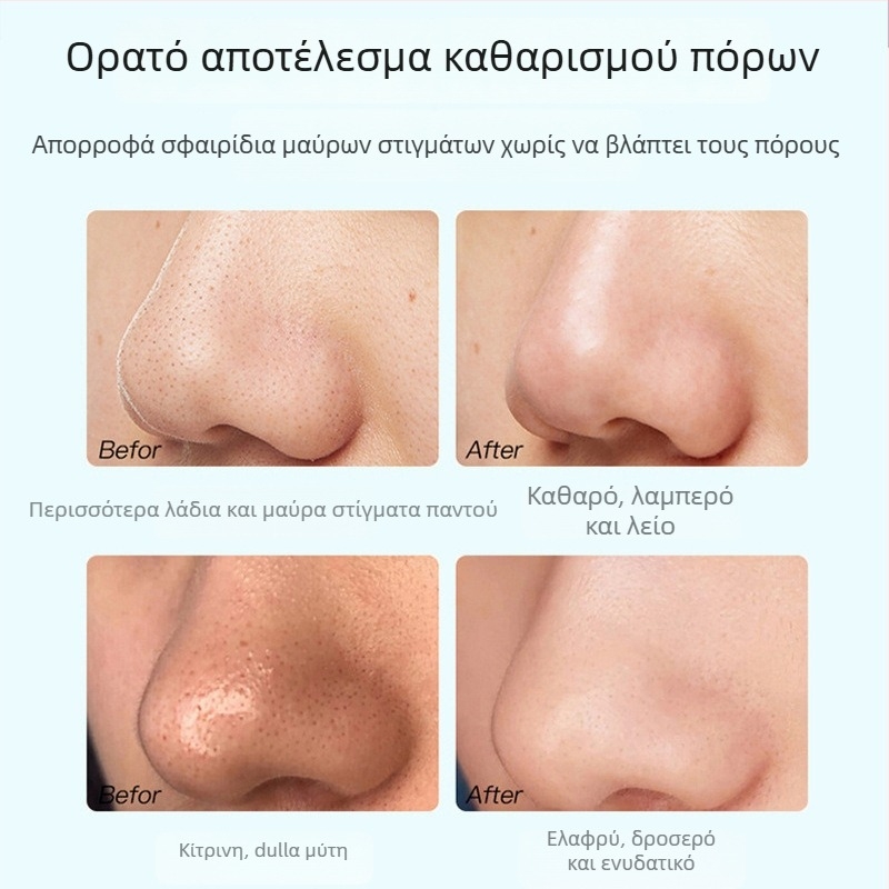 Μάσκα απομάκρυνσης μαύρων στιγμάτων με εκχύλισμα τσαγιού – σετ τριών τεμαχίων, φροντίδα ζώνης Τ, σύσφιξη πόρων, έλεγχος λιπαρότητας, ενυδάτωση